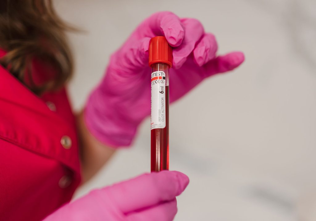 Pielęgniarka Centrum Medycznego neoMedica w Poznaniu trzyma w rękawiczkach lekarskich fiolkę z kwią.