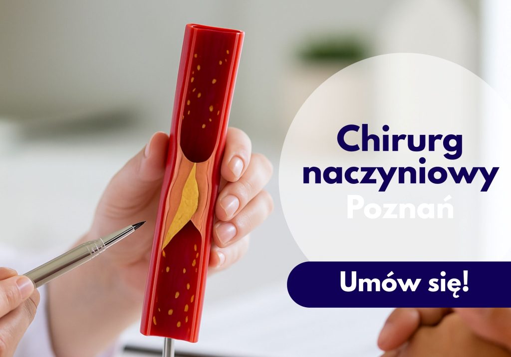 Chirurg naczyniowy Centrum Medycznego neoMedica w Poznaniu wskazuje na model naczycia krwionośnego.