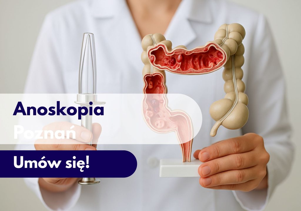 Lekarz trzymający model narządu jelita i narzędzie do wykonania anoskopii - ilustracja dotycząca anoskopii w Centrum Medycznym neomedica w Poznaniu.