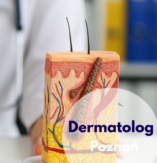 Dermatolog Centrum Medyczmego neoMedica w Poznaniu wskazuje na model przekroju skóry.