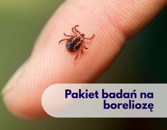 Kleszcz na palcu - ilustracja dotycząca Pakietu badań na boleriozę w Centrum Medycznym neoMedica w Poznaniu