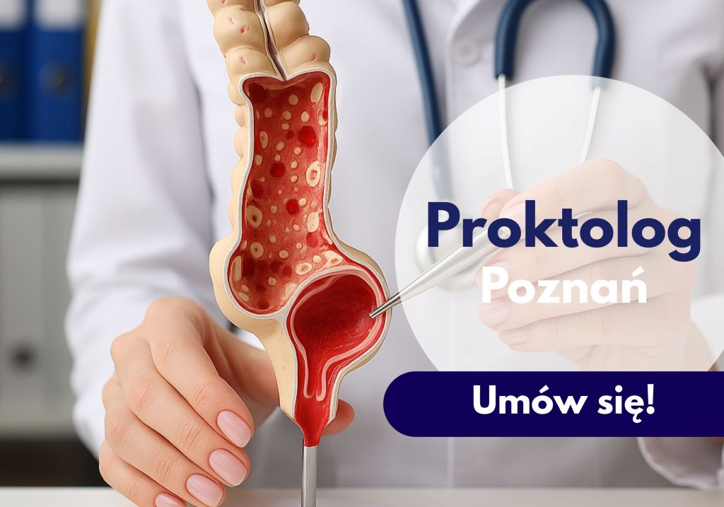 Lekarz ze stetoskopem na szyiu wskazuje na model końcowego jelita grubego na konsultacji proktologicznej w Centrum Medycznym neoMedica w Poznaniu.