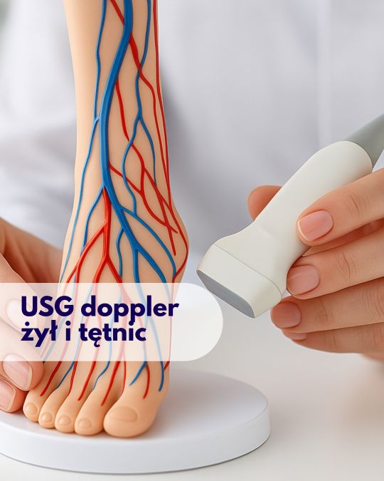 Lekarz przykłada głowicę USG do modelu stopy z zaznaczonym przebiegiem żył podczas wizyty w Centrum Medycznym neoMedica w Poznaniu – ilustracja dotycząca USG Doppler żył i tętnic.