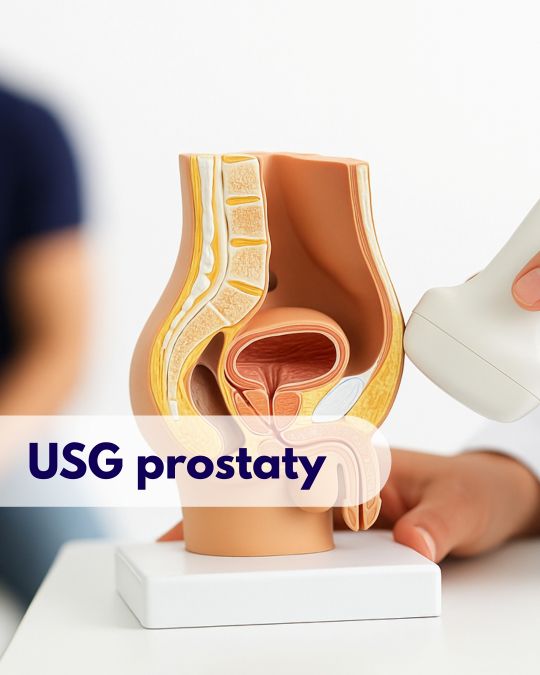 Głowica USG przykładana przez lekarza do modelu przedstawiającego prostatę, w tle zamazana sylwetka mężczyzny podczas wizyty w Centrum Medycznym neoMedica w Poznaniu.