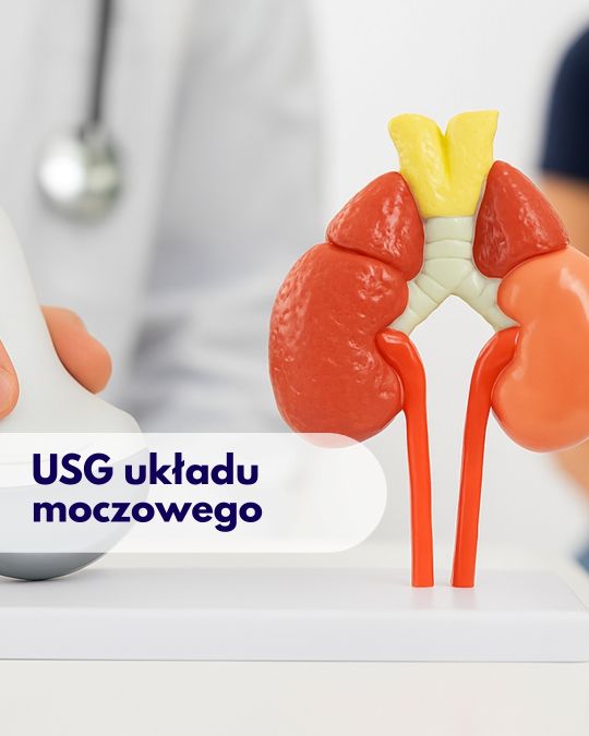 Głowica USG przykładana przez lekarza do modelu przedstawiającego układ moczowy, w tle zamazana sylwetka kobiety podczas wizyty w Centrum Medycznym neoMedica w Poznaniu.